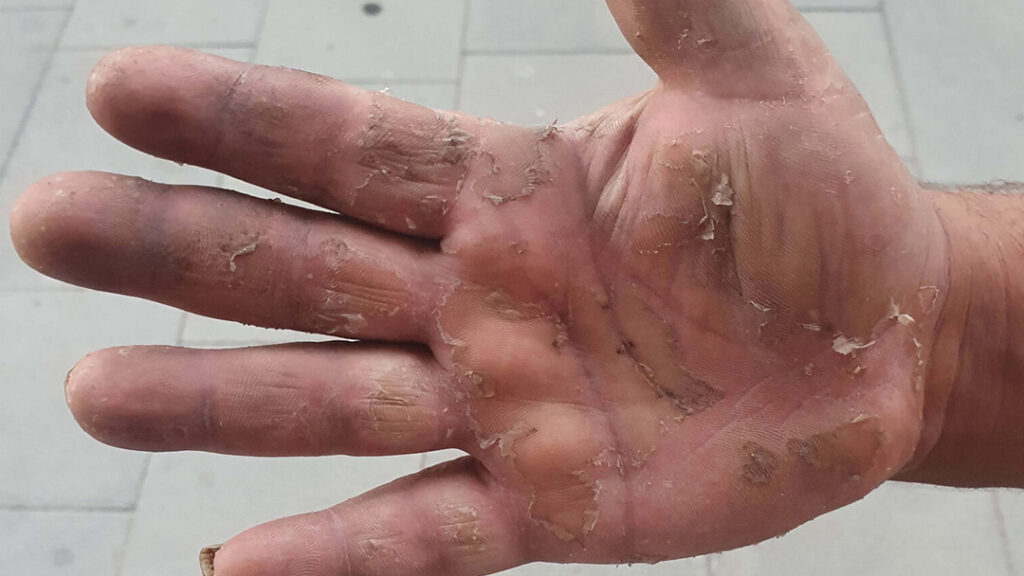 Dopo un decennio a raccogliere frutta a Cerignola: le mani di Ciprian Dumbravă – Foto: Vlad Odobescu