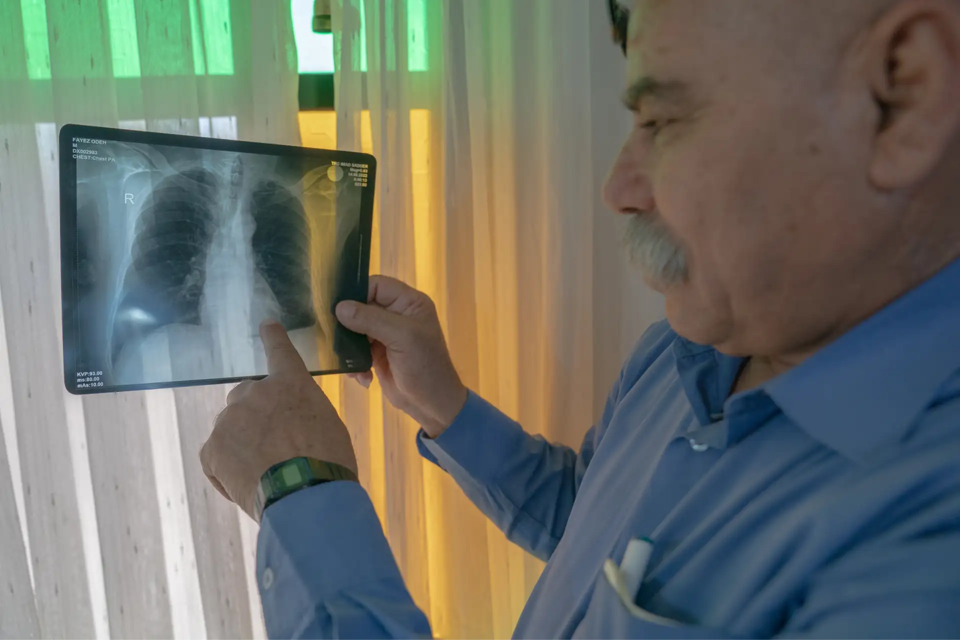 Tulkarm, West Bank, Palestina. Fayez, 66 anni, agricoltore, mostra la sua radiografia del torace, che evidenzia segni di danni polmonari. Secondo i medici, ha una capacità polmonare ridotta e non può più coltivare i suoi terreni agricoli situati accanto al complesso industriale di Nitzanei Shalom a causa dell’inquinamento atmosferico nella zona